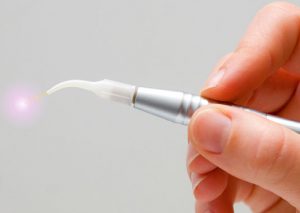 dental laser