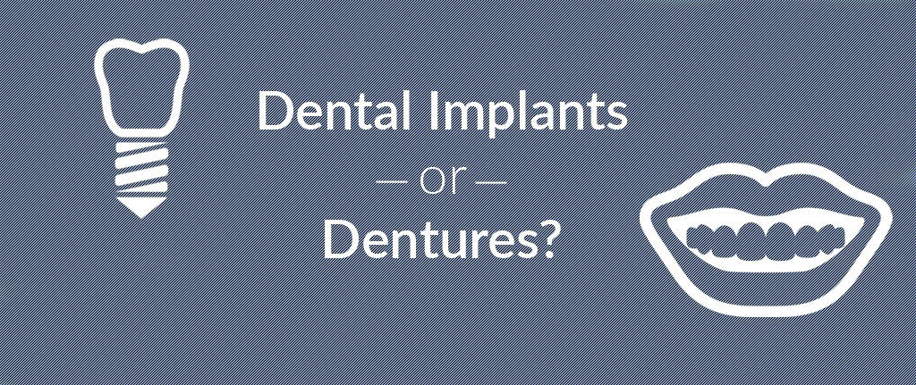 Dental Implants or Dentures