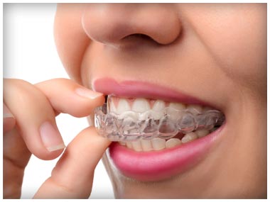 Invisalign Patient