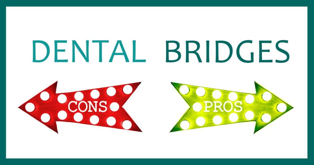 Dental Bridges Pros Cons